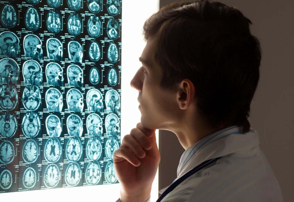 A doctor reviewing a hypoxic brain injury results.