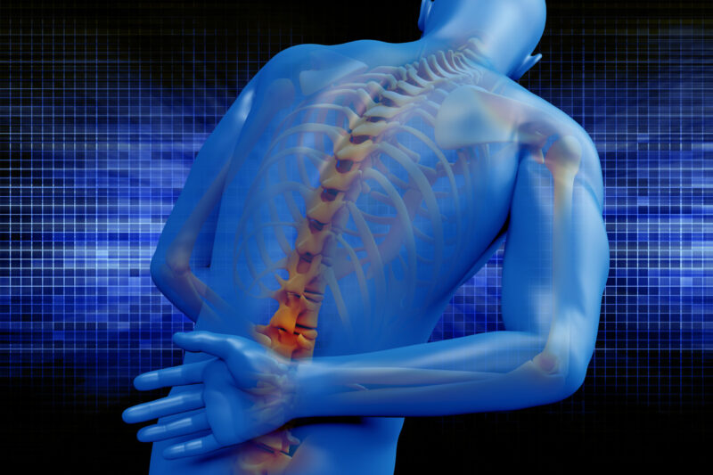 Average Settlement for Spinal Cord Injury in Washington 